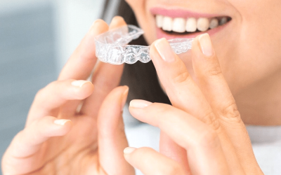 How to Insert & Remove Your Invisalign